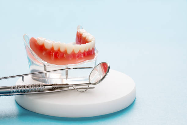 Dental Bonding in Greensboro, MD