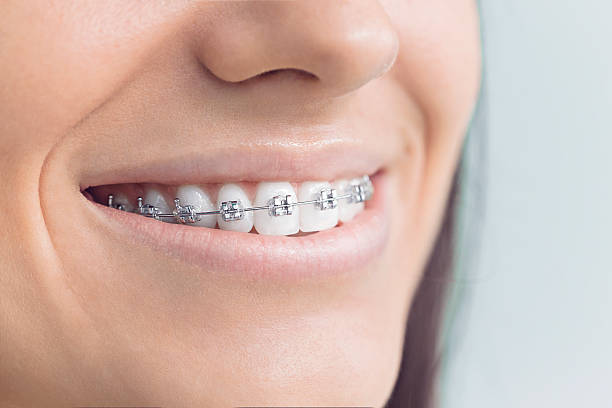 Best Traditional Braces  in Greensboro, MD